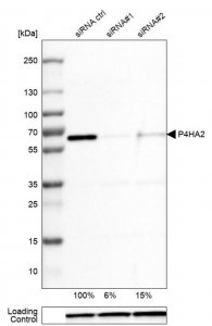 Monoclonal Anti-P4HA2 antibody produced in mouse 