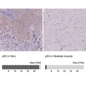 Monoclonal Anti-p53 antibody produced in mouse 