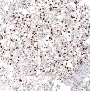 Monoclonal Anti-PAX2 antibody produced in mouse AMAB91573-100UL