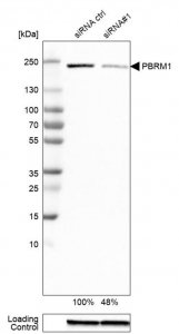 Monoclonal Anti-PBRM1 antibody produced in mouse 