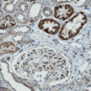 Monoclonal Anti-PGAM5 antibody produced in mouse 