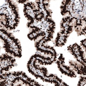 Monoclonal Anti-PGR antibody produced in mouse AMAB91529-100UL