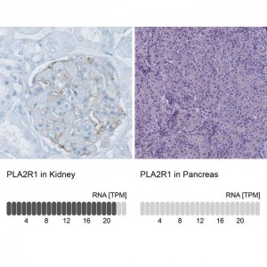 Monoclonal Anti-PLA2R1 antibody produced in mouse 