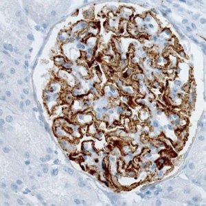 Monoclonal Anti-PLA2R1 antibody produced in mouse 