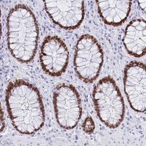 Monoclonal Anti-SATB2 antibody produced in mouse 
