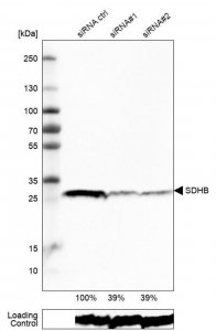 Monoclonal Anti-SDHB antibody produced in mouse 