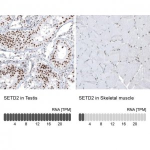 Monoclonal Anti-SETD2 antibody produced in mouse AMAB91603-100UL