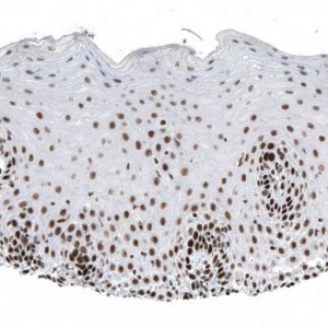 Monoclonal Anti-SETD2 antibody produced in mouse AMAB91603-100UL