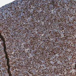 Monoclonal Anti-SOX11 antibody produced in mouse 
