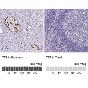 Monoclonal Anti-TTR antibody produced in mouse 