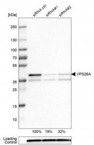 Monoclonal Anti-VPS26A antibody produced in mouse 