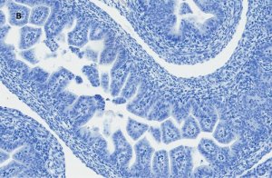 SOX 9 antibody 