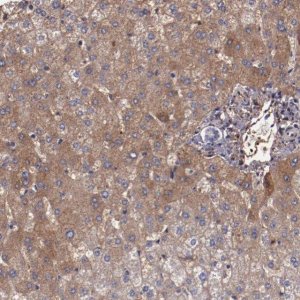Anti-A2M antibody produced in rabbit 