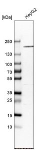 Anti-A2M antibody produced in rabbit 
