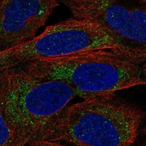 Anti-A4GALT antibody produced in rabbit 