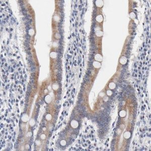 Anti-AADAC antibody produced in rabbit 