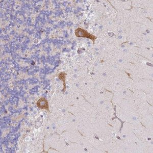 Anti-AADACL4 antibody produced in rabbit 