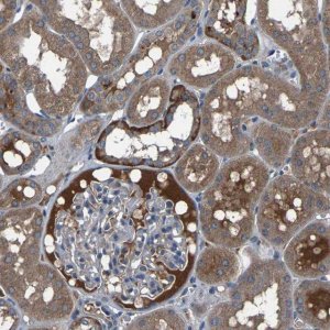Anti-AAED1 antibody produced in rabbit 