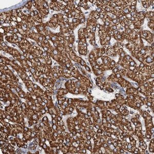 Anti-AAGAB antibody produced in rabbit 