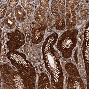 Anti-AAGAB antibody produced in rabbit HPA040174-100UL
