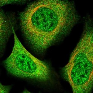 Anti-AAGAB antibody produced in rabbit HPA040174-100UL