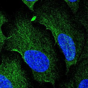 Anti-AAMP antibody produced in rabbit 