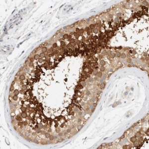Anti-AARSD1 antibody produced in rabbit HPA023714-100UL