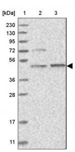 Anti-AARSD1 antibody produced in rabbit HPA023714-100UL