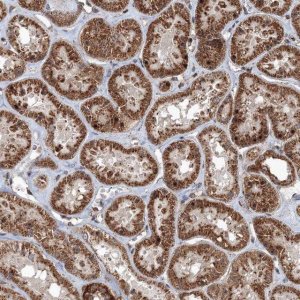 Anti-AASDH antibody produced in rabbit 
