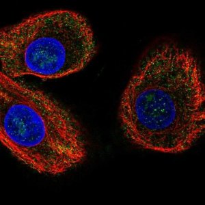 Anti-ABCA12 antibody produced in rabbit 