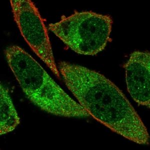 Anti-ABCA13 antibody produced in rabbit 