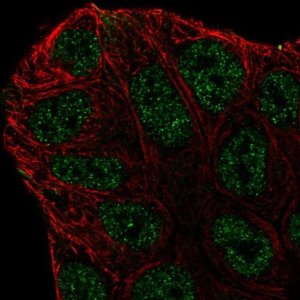 Anti-ABCA6 antibody produced in rabbit 