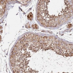 Anti-ABCB6 antibody produced in rabbit 