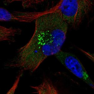 Anti-ABCB6 antibody produced in rabbit 
