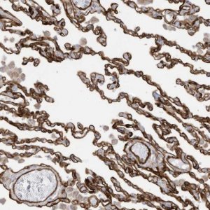 Anti-ABCB7 antibody produced in rabbit 