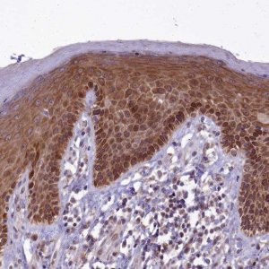 Anti-ABCB8 antibody produced in rabbit 
