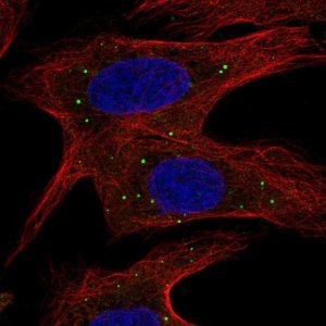 Anti-ABCB9 antibody produced in rabbit 
