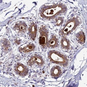 Anti-ABCC10 antibody produced in rabbit 