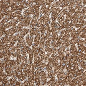 Anti-ABCC11 antibody produced in rabbit 