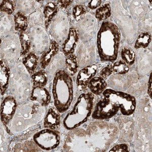 Anti-ABCC11 antibody produced in rabbit 