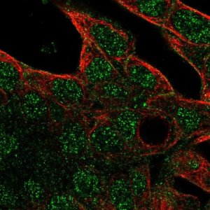 Anti-ABCC6 antibody produced in rabbit 