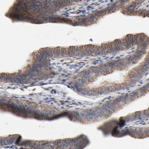 Anti-ABCD4 antibody produced in rabbit 
