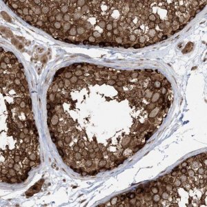 Anti-ABCF3 antibody produced in rabbit 