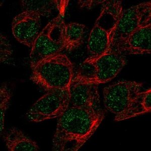 Anti-ABCG5 antibody produced in rabbit 
