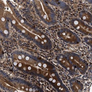 Anti-ABCG8 antibody produced in rabbit 