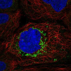 Anti-ABHD10 antibody produced in rabbit 
