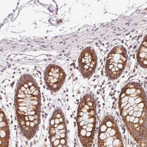 Anti-ABHD11 antibody produced in rabbit 