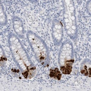 Anti-ABHD12 antibody produced in rabbit 