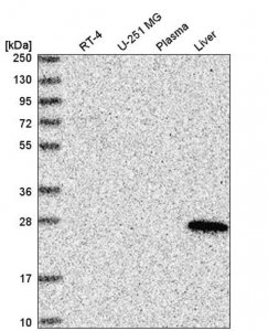 Anti-ABHD14A antibody produced in rabbit HPA038153-100UL