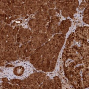Anti-ABHD14B antibody produced in rabbit 